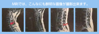 慢性疾患にお悩みの方へ